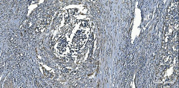 Anti-MCU Antibody