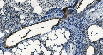 Anti-MCU Antibody