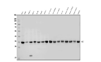 Anti-MCU Antibody