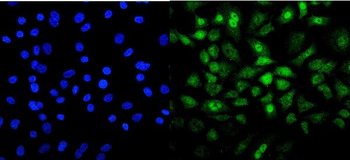 Anti-Mesp2 Antibody