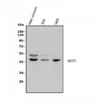 Anti-Mesp2 Antibody