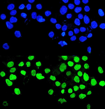 Anti-MMP28 Antibody