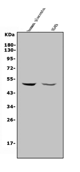 Anti-MMP28 Antibody