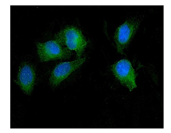Anti-SEZ6L Antibody