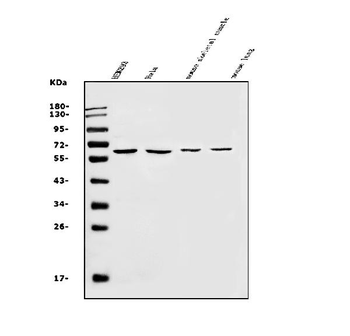 Anti-SLC22A3 Antibody