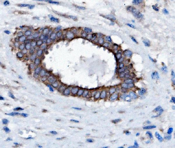 Anti-Slc25a1 Antibody