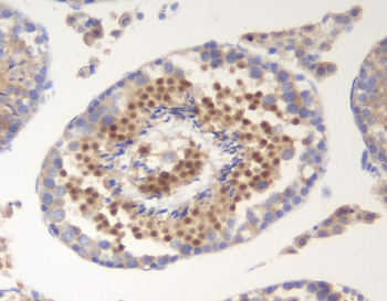 Anti-SOX6 Antibody