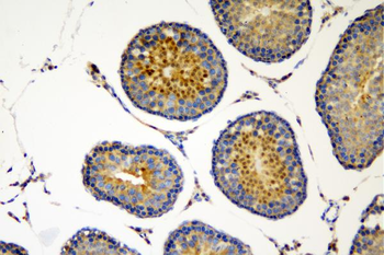 Anti-SOX6 Antibody