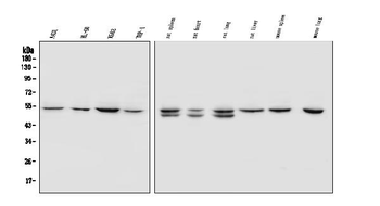 Anti-SOX11 Antibody