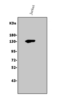 Anti-Thrombospondin/THBS1 Antibody