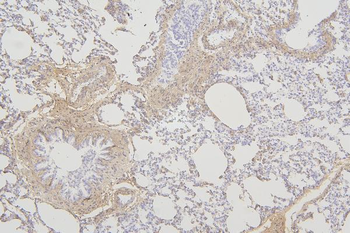 Anti-Tmem255b Antibody