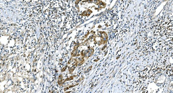 Anti-DR6/TNFRSF21 Antibody