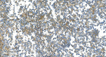 Anti-DR6/TNFRSF21 Antibody