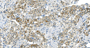 Anti-DR6/TNFRSF21 Antibody