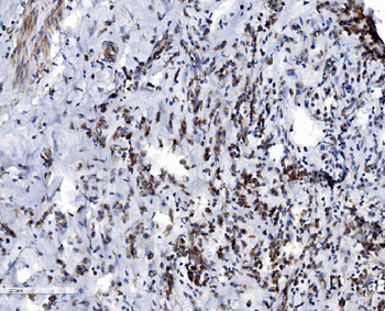 Anti-VDAC3 Antibody