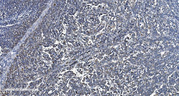 Anti-VDAC3 Antibody