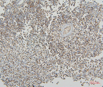 Anti-VDAC3 Antibody