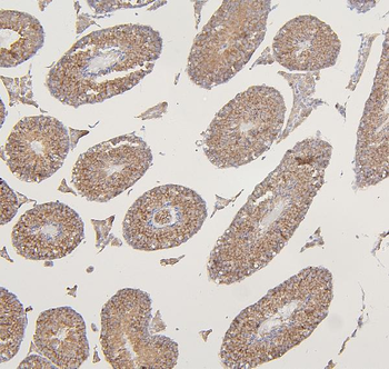 Anti-VDAC3 Antibody