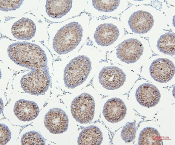 Anti-VDAC3 Antibody