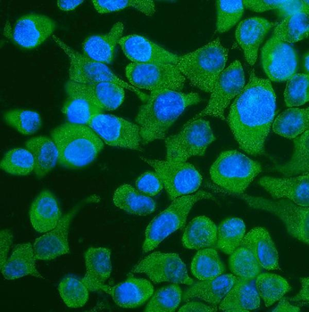 Anti-YTHDF2 Antibody