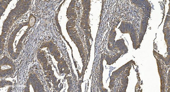 Anti-YTHDF2 Antibody