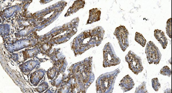 Anti-YTHDF2 Antibody