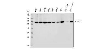 Anti-YTHDF2 Antibody