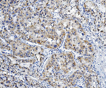 ALDH6A1 Rabbit Polyclonal Antibody