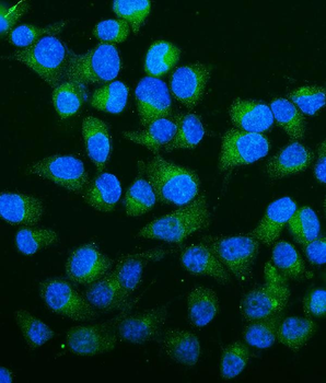 Anti-Carbonic Anhydrase 13/CA13 Antibody