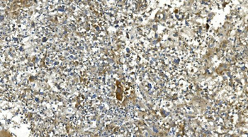 Anti-Carbonic Anhydrase 13/CA13 Antibody