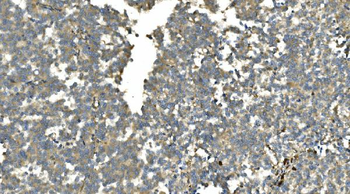 Anti-Carbonic Anhydrase 13/CA13 Antibody