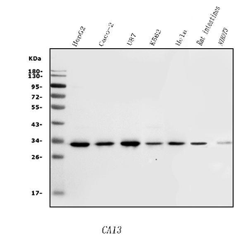 Anti-Carbonic Anhydrase 13/CA13 Antibody