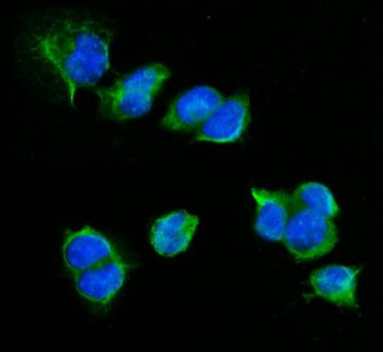 Anti-CD72 Antibody