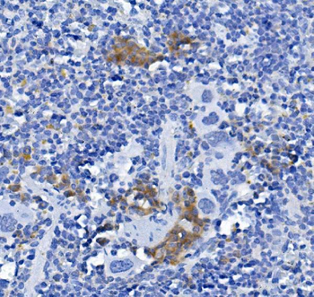 Anti-CD72 Antibody