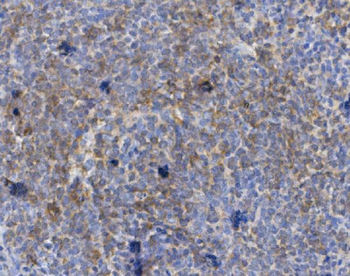 Anti-CD72 Antibody