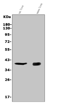 Anti-CD72 Antibody