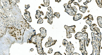 Anti-CDC123 Antibody