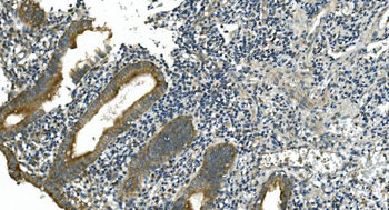 Anti-CDC123 Antibody