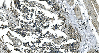 Anti-CDC123 Antibody