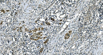 Anti-CDC123 Antibody