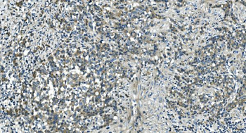 Anti-CDC123 Antibody
