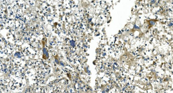 Anti-CDC123 Antibody
