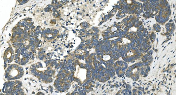 Anti-CDC123 Antibody