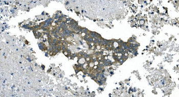 Anti-CDC123 Antibody