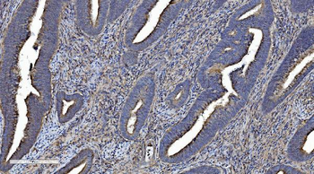 Anti-LOC134147/CMBL Antibody