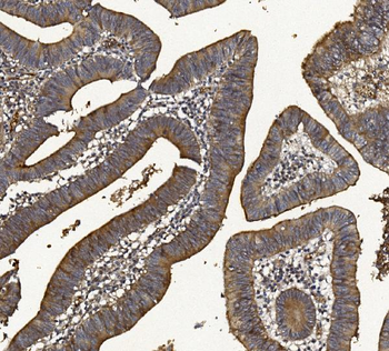 MUC1 Rabbit Polyclonal Antibody