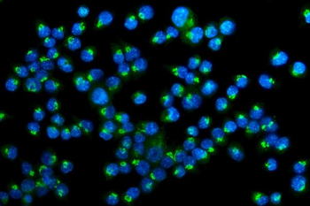 Anti-Golm1/GOLPH2 Antibody