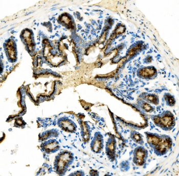 Anti-Golm1/GOLPH2 Antibody
