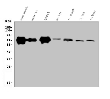 Anti-Golm1/GOLPH2 Antibody