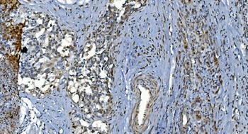 Anti-GRX2/GLRX2 Antibody